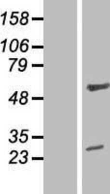 Western Blot: ZNF101 Overexpression Lysate [NBP2-05898]