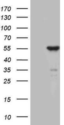 Western Blot: ZNF114 Antibody (OTI6F4) [NBP2-46416]