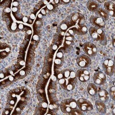 Immunohistochemistry-Paraffin: ZNF114 Antibody [NBP1-81180]