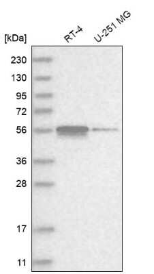 Western Blot: ZNF114 Antibody [NBP1-81181]