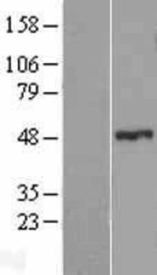 Western Blot: ZNF114 Overexpression Lysate [NBP2-05247]