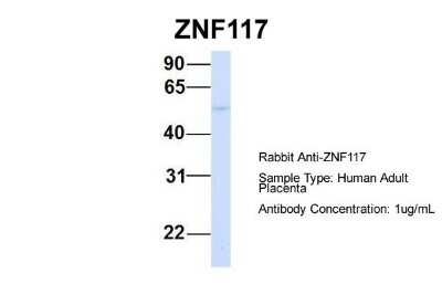 Western Blot: ZNF117 Antibody [NBP1-79243]