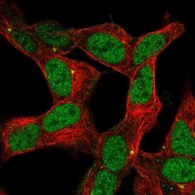 Immunocytochemistry/ Immunofluorescence: ZNF12 Antibody [NBP2-55975]