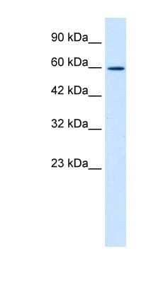 Western Blot: ZNF12 Antibody [NBP1-80116]