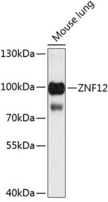 Western Blot: ZNF12 AntibodyBSA Free [NBP2-94653]