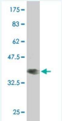 Western Blot: ZNF121 Antibody (3H2) [H00007675-M08]