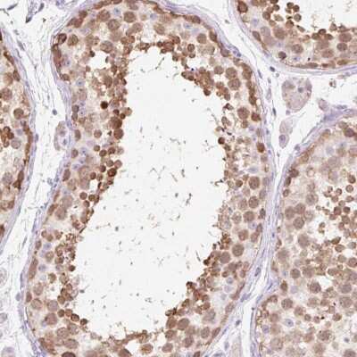 Immunohistochemistry: ZNF121 Antibody [NBP2-49161]