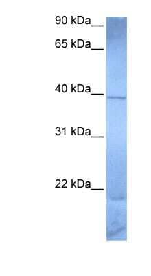 Western Blot: ZNF121 Antibody [NBP1-79350]