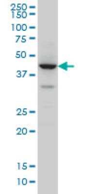 Western Blot: ZNF124 Antibody (4G4) [H00007678-M01]