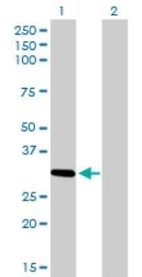 Western Blot: ZNF124 Antibody (4G4) [H00007678-M01]