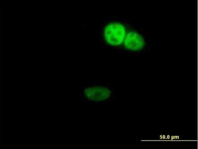 Immunocytochemistry/ Immunofluorescence: ZNF124 Antibody [H00007678-B01P]