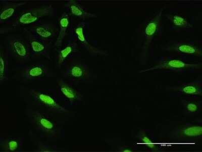 Immunocytochemistry/ Immunofluorescence: ZNF124 Antibody [H00007678-D01P]