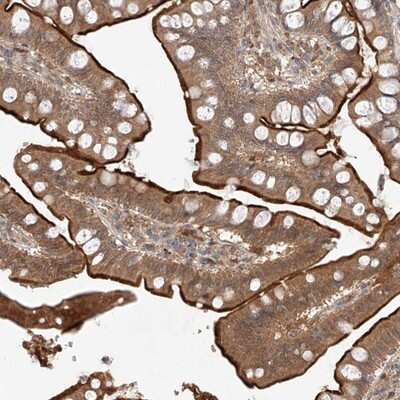 Immunohistochemistry-Paraffin: ZNF124 Antibody [NBP1-81634]