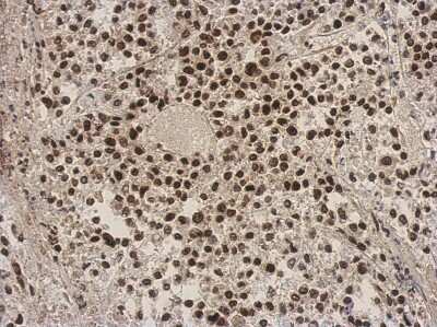Immunohistochemistry-Paraffin: ZNF124 Antibody [NBP2-20961]