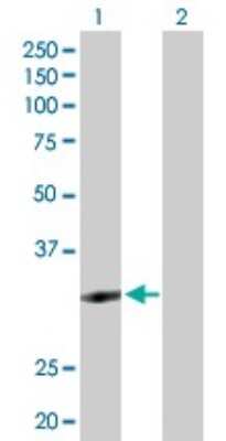 Western Blot: ZNF124 Antibody [H00007678-D01P]