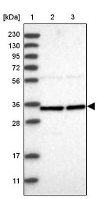 Western Blot: ZNF124 Antibody [NBP1-81634]