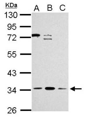 Western Blot: ZNF124 Antibody [NBP2-20961]