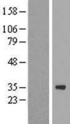 Western Blot: ZNF124 Overexpression Lysate [NBP2-08010]