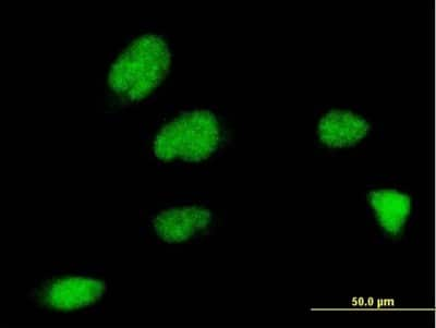 Immunocytochemistry/ Immunofluorescence: ZNF131 Antibody (5F1) [H00007690-M07]