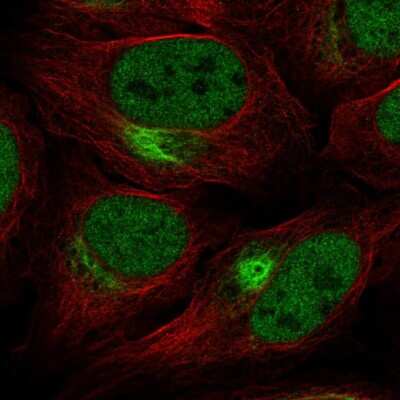 Immunocytochemistry/ Immunofluorescence: ZNF131 Antibody [NBP2-57688]