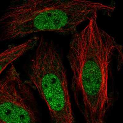 Immunocytochemistry/ Immunofluorescence: ZNF131 Antibody [NBP2-58632]