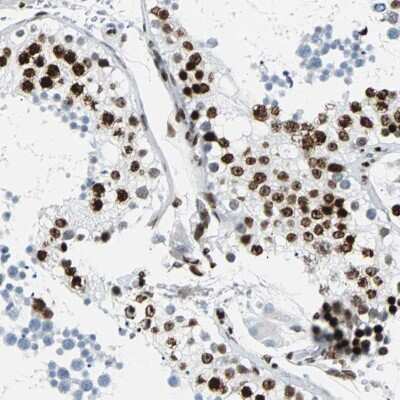 Immunohistochemistry: ZNF131 Antibody [NBP2-48505]