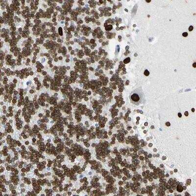 Immunohistochemistry-Paraffin: ZNF132 Antibody [NBP1-80915]