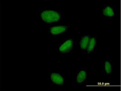 Immunocytochemistry/ Immunofluorescence: ZNF133 Antibody [H00007692-B02P]
