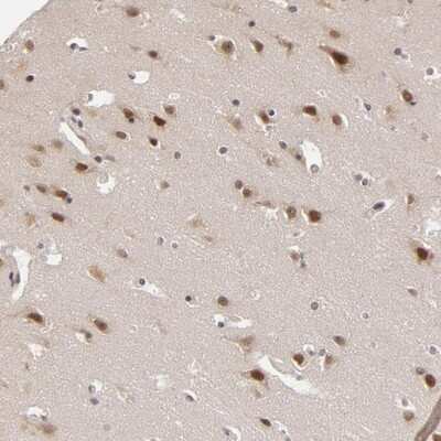 Immunohistochemistry-Paraffin: ZNF133 Antibody [NBP1-80914]
