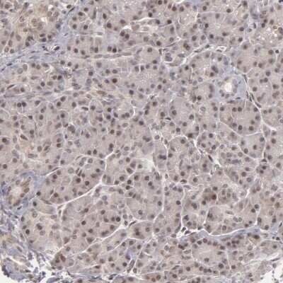 Immunohistochemistry-Paraffin: ZNF133 Antibody [NBP1-80914]