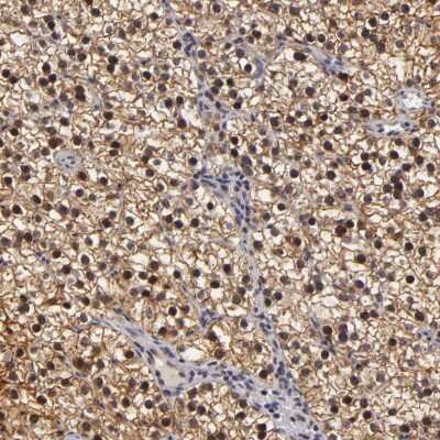 Immunohistochemistry-Paraffin: ZNF133 Antibody [NBP1-80914]
