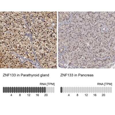 Immunohistochemistry-Paraffin: ZNF133 Antibody [NBP1-80914]
