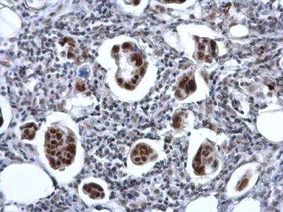 Immunohistochemistry-Paraffin: ZNF133 Antibody [NBP2-20963]
