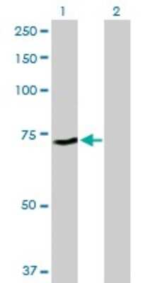 Western Blot: ZNF133 Antibody [H00007692-B01P]