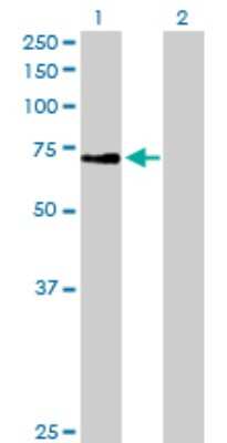 Western Blot: ZNF133 Antibody [H00007692-B02P]