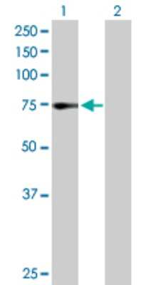 Western Blot: ZNF133 Antibody [H00007692-D01P]