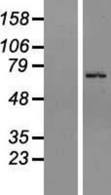 Western Blot: ZNF133 Overexpression Lysate [NBL1-18056]