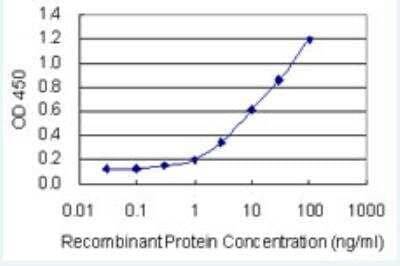 ELISA: ZNF134 Antibody (2D10) [H00007693-M03-100ug]