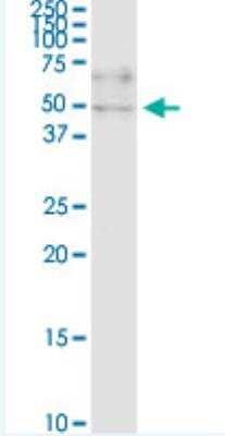 Western Blot: ZNF134 Antibody (2D10) [H00007693-M03-100ug]