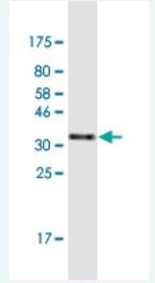 Western Blot: ZNF134 Antibody (2D10) [H00007693-M03-100ug]