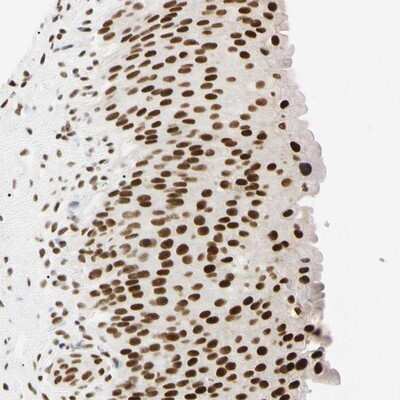 Immunohistochemistry-Paraffin: ZNF134 Antibody [NBP1-87277]