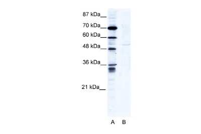 Western Blot: ZNF134 Antibody [NBP2-86435]