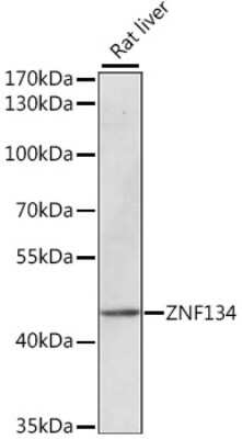 Western Blot: ZNF134 AntibodyAzide and BSA Free [NBP2-93519]