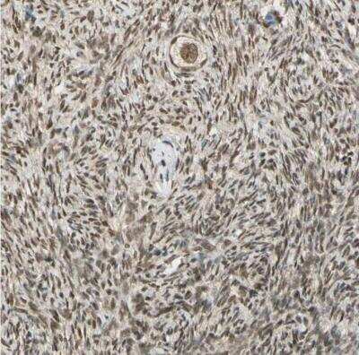 Immunohistochemistry-Paraffin: ZNF135 Antibody [NBP1-80913]