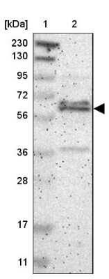 Western Blot: ZNF135 Antibody [NBP1-80913]