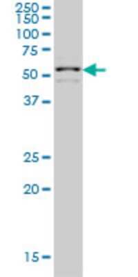 Western Blot: ZNF136 Antibody (5E9) [H00007695-M03]