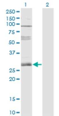 Western Blot: ZNF138 Antibody (4D11) [H00007697-M01]