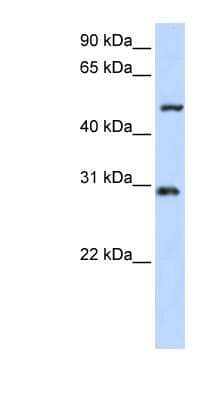 Western Blot: ZNF138 Antibody [NBP1-79235]