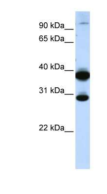 Western Blot: ZNF138 Antibody [NBP1-79236]