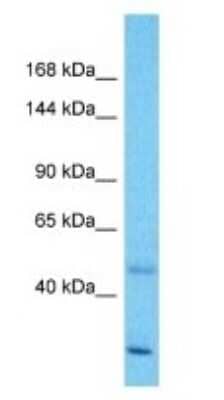 Western Blot: ZNF138 Antibody [NBP3-09235]